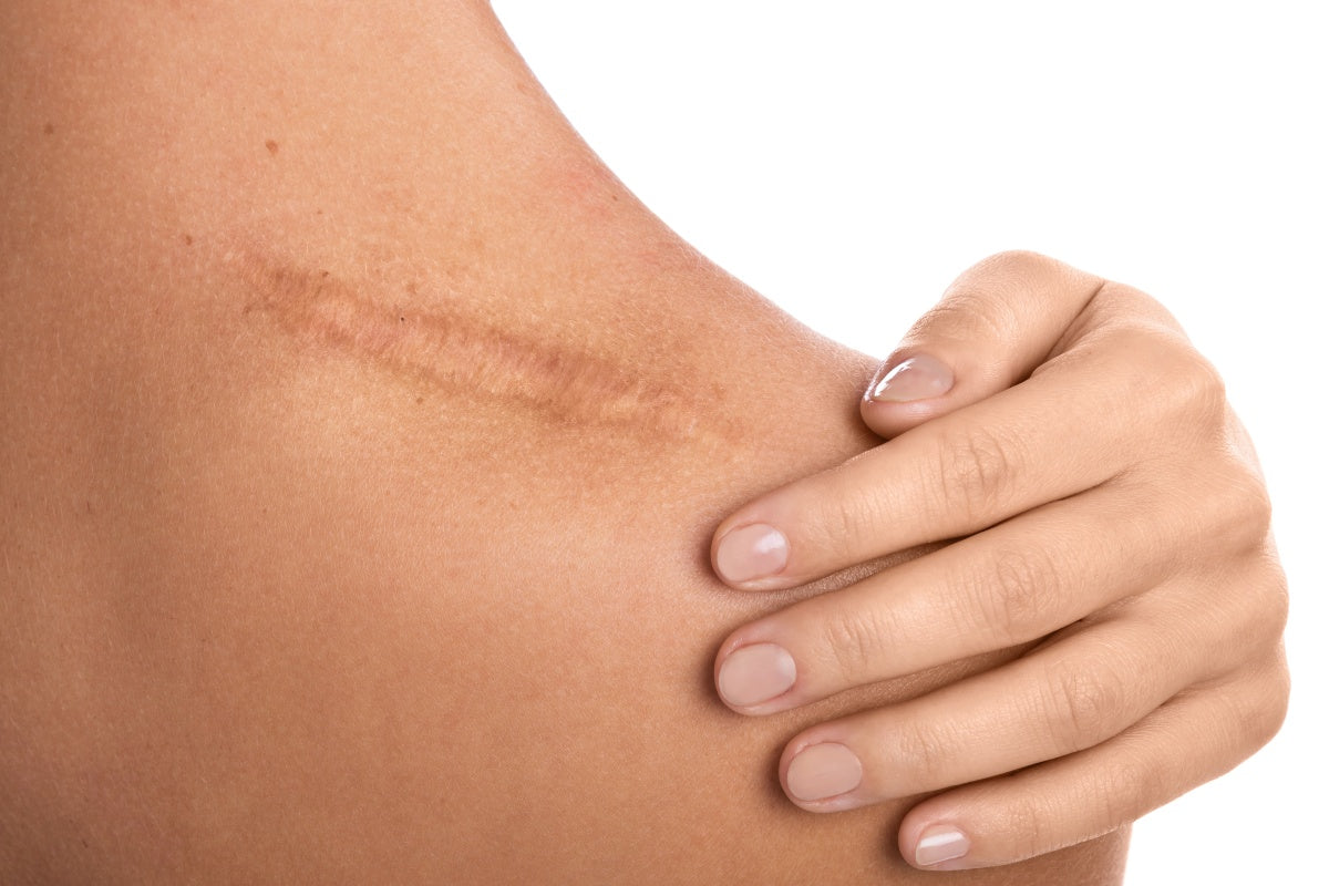 does red light therapy help heal wounds