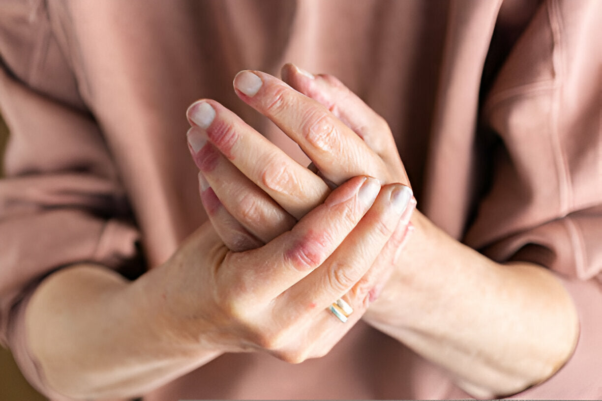 red light therapy for psoriasis
