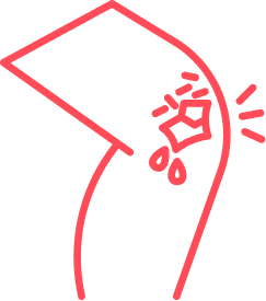 Illustration of an elbow with an injury highlighted in red.